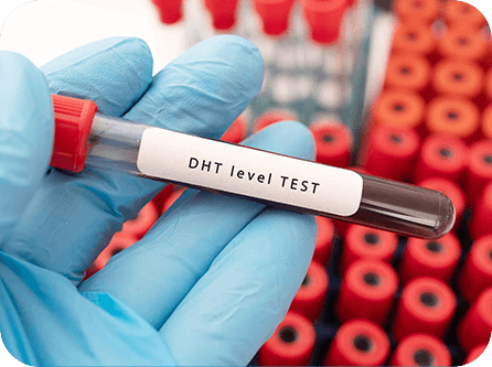 Supporting Healthy DHT Levels
