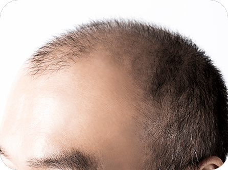 Scalp Support